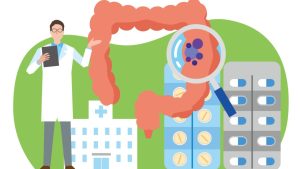 大腸カメラを受けないリスクとは？ 放置された大腸ポリープはどうなる？【医師解説】