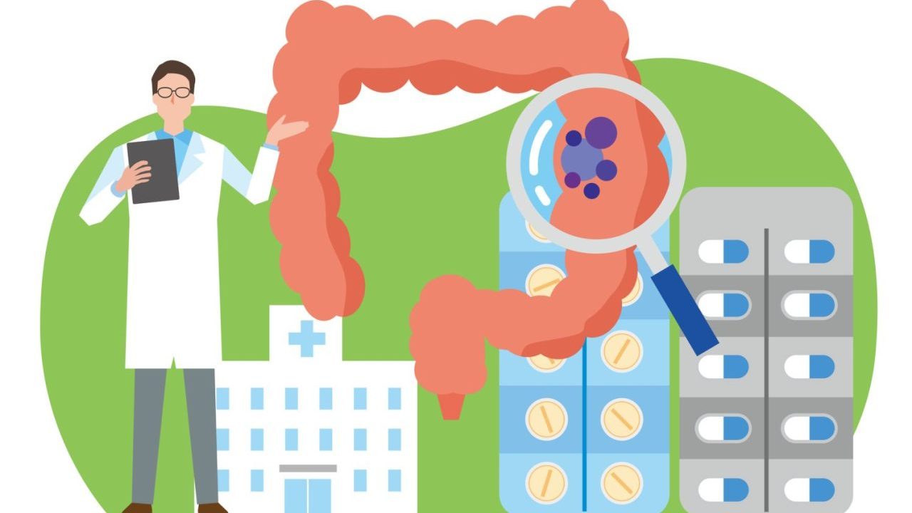 大腸カメラを受けないリスクとは? 放置された大腸ポリープはどうなる?【医師解説】