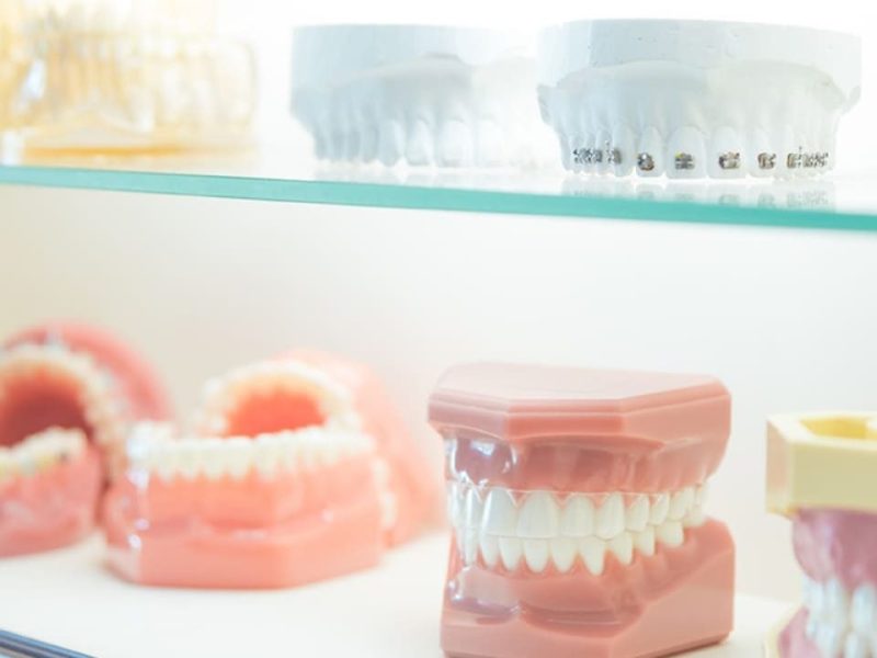 うえの矯正歯科