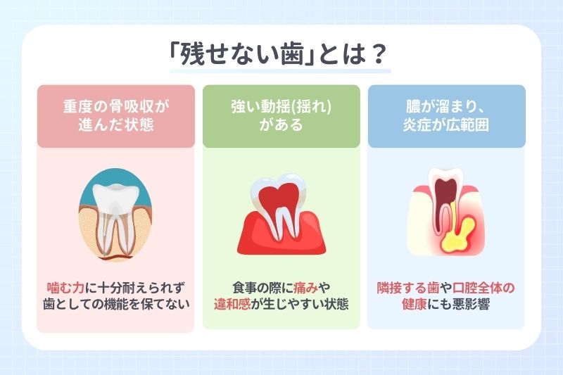 ｢残せない歯｣とは？