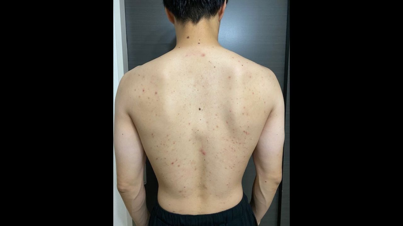 過信せず、「定期的な検診」と「生活習慣の見直し」を！