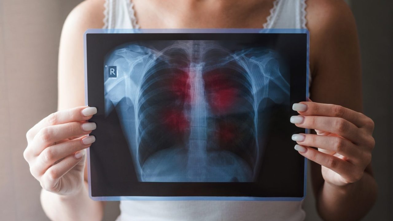 【闘病】『肺がん』告知で目の前が真っ白に… 「なぜこのタイミングで」