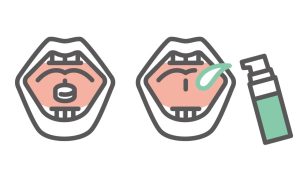 途中でやめるとどうなる？ 『花粉症』舌下免疫療法の期間と再開時の注意