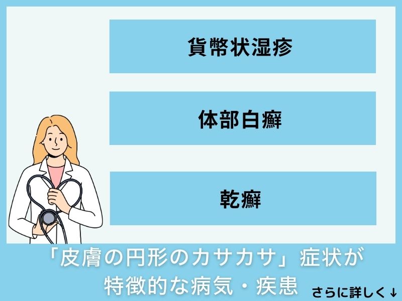 「皮膚の円形のカサカサ」症状が特徴的な病気・疾患