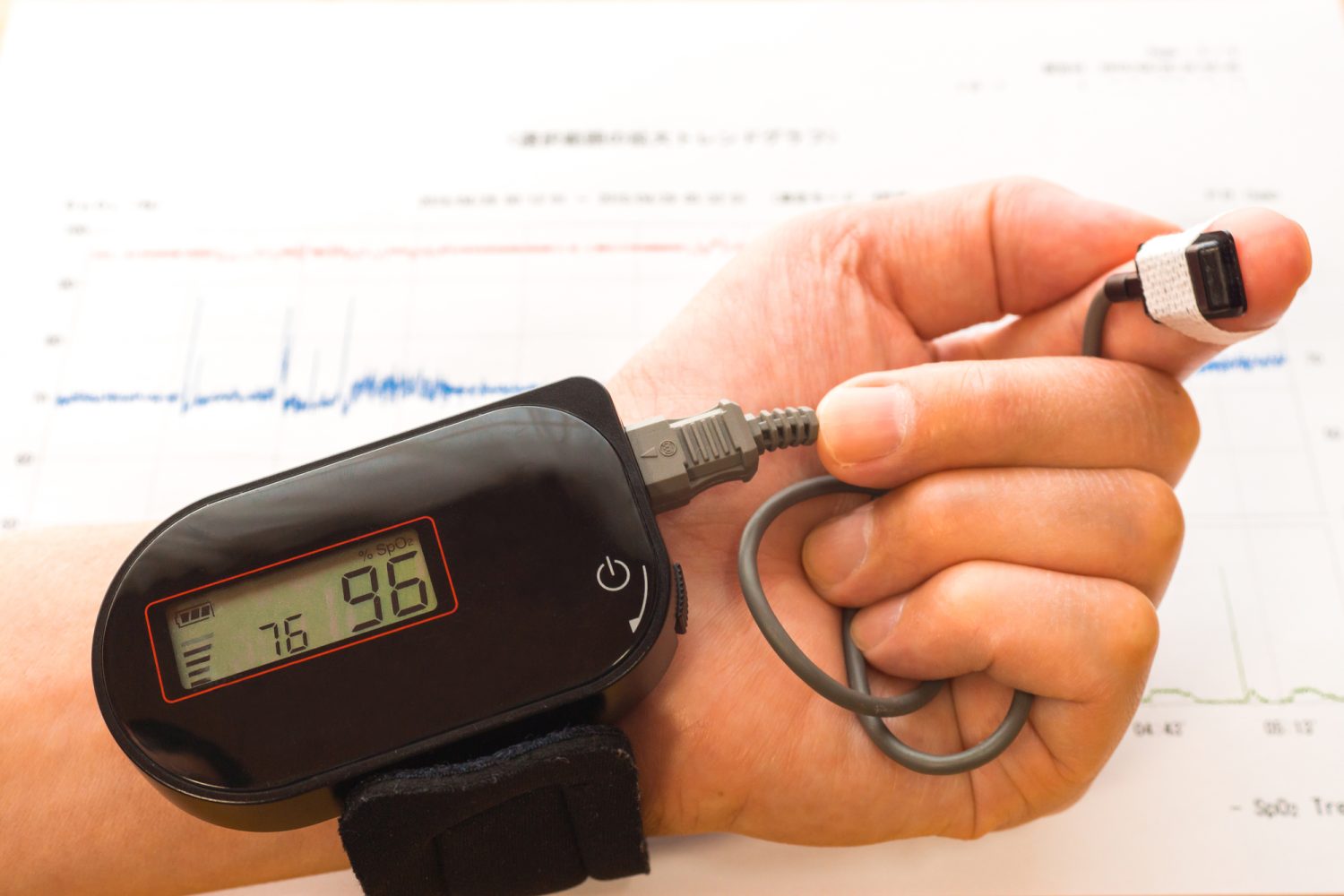 睡眠時無呼吸症候群の検査はどうやって行われるの？