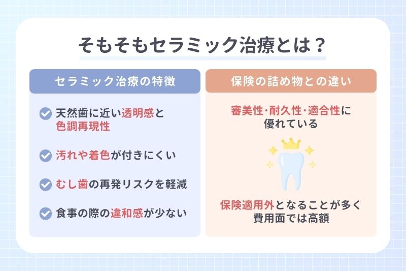 そもそもセラミック治療とは？