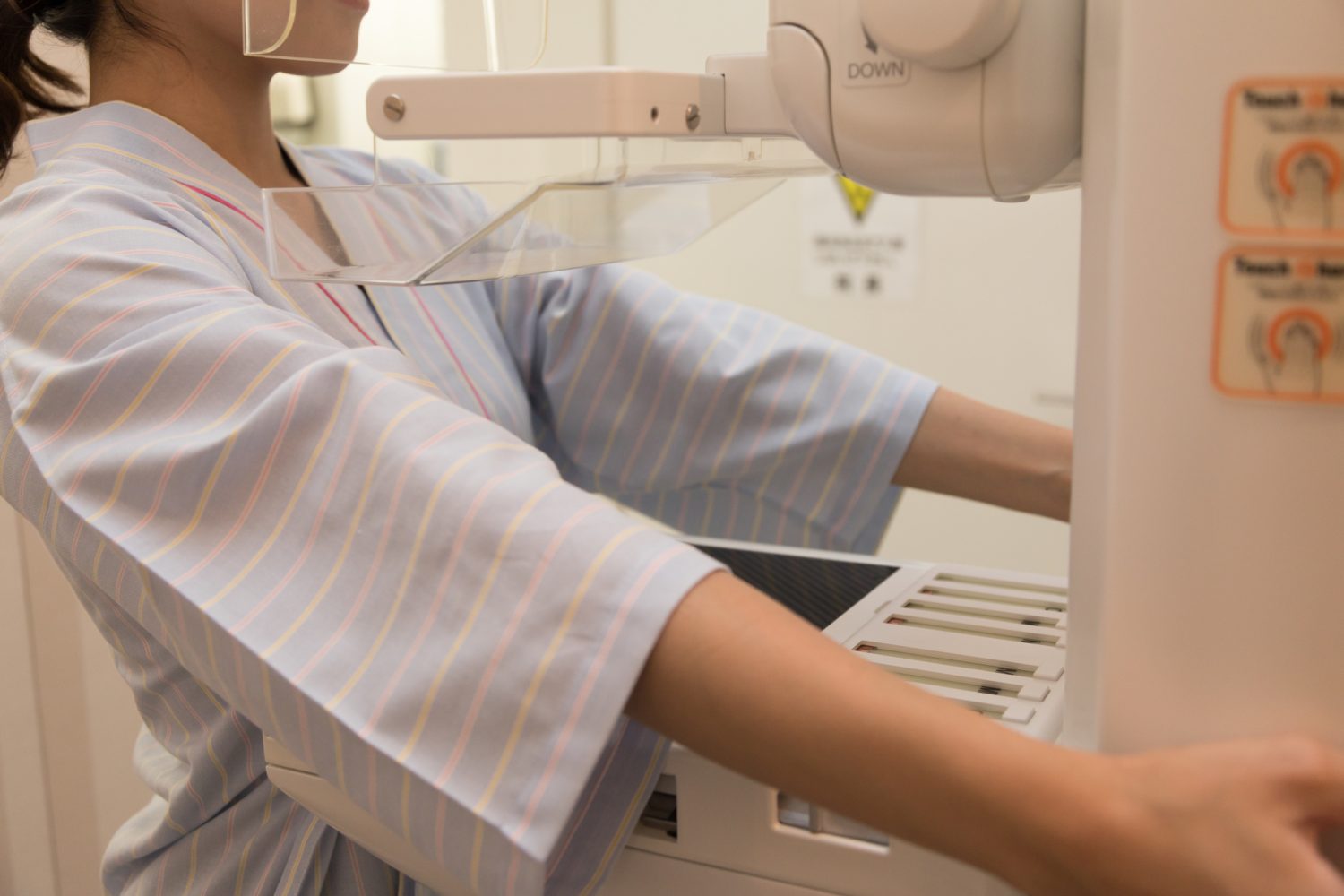 要精密検査と判定されたら「組織診」など詳細検査を追加実施