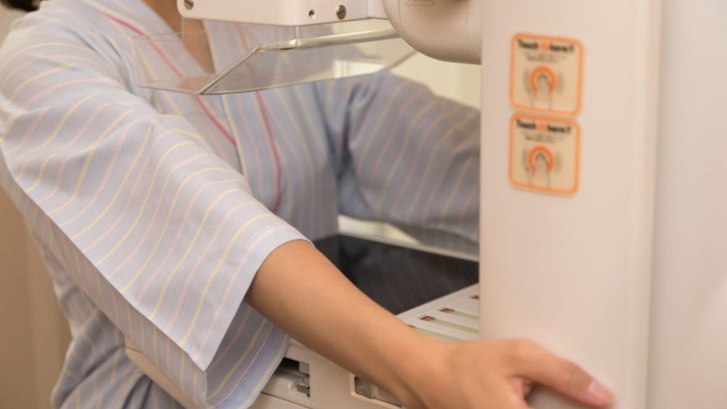 マンモグラフィは痛い？ 被ばくする？ エコーとの違いは？「乳がん検診の疑問」を一挙解説