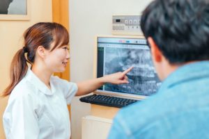 インプラント費用の違いはなぜ生まれる？後悔しないための選び方を専門の歯科医師が解説