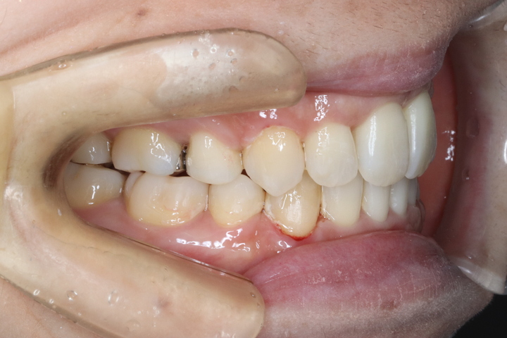 つちだ矯正歯科クリニック