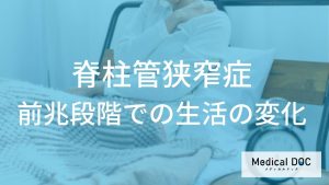 脊柱管狭窄症の前兆段階での生活の変化