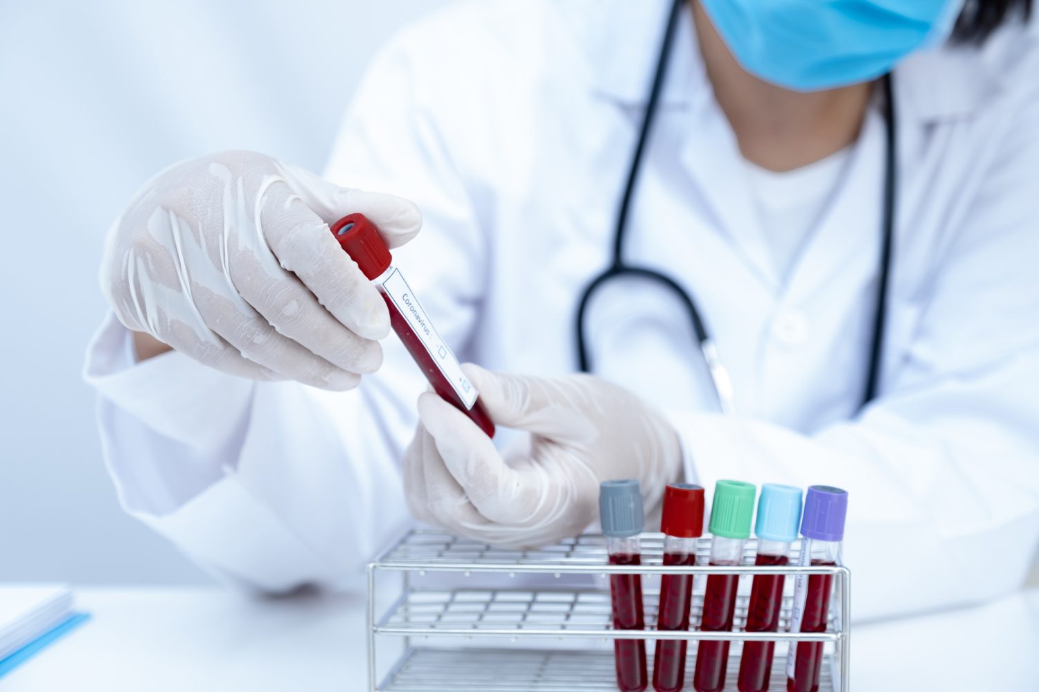 負担の少ない血液検査によるアルツハイマー病診断の未来