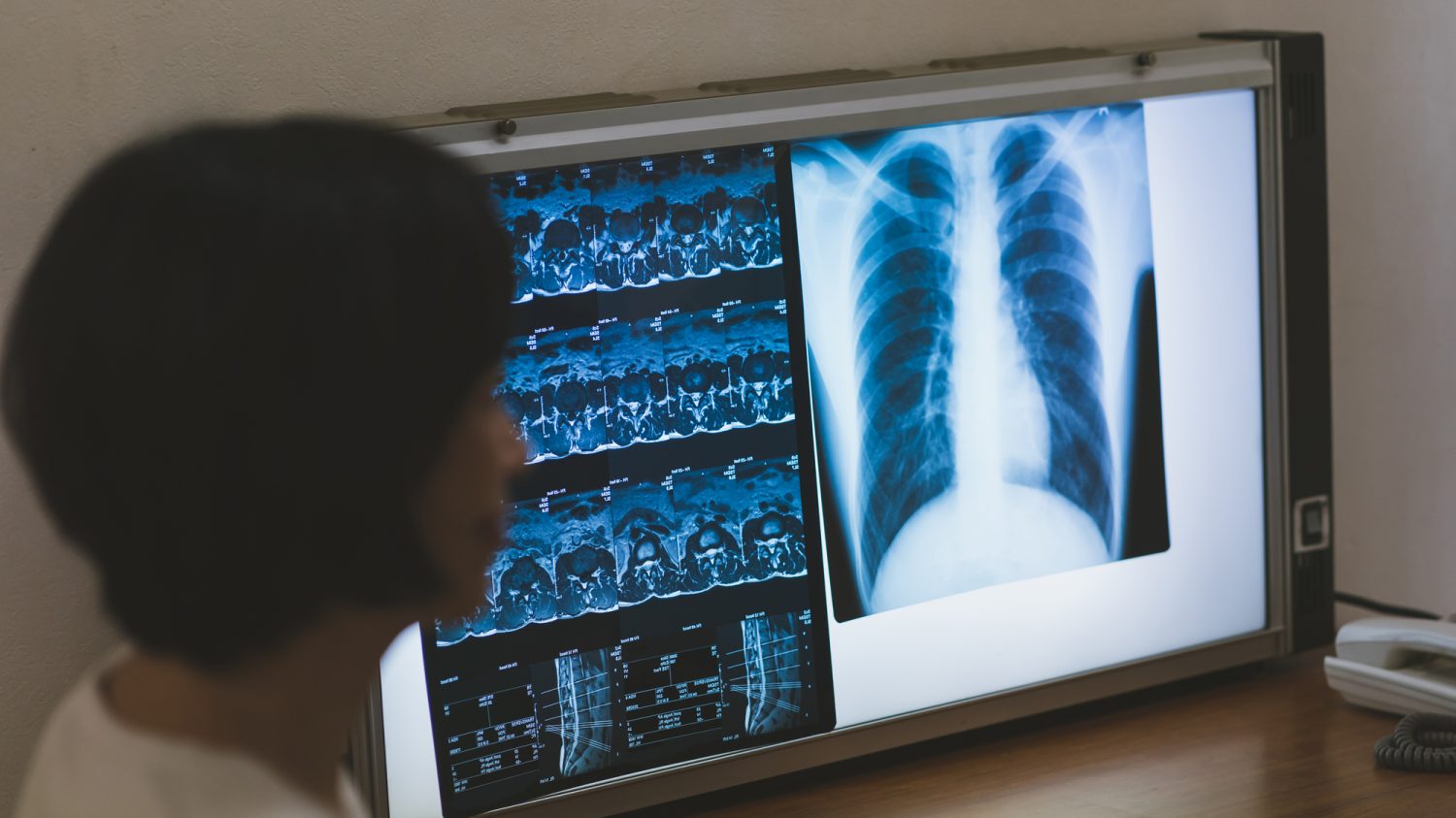 たばこを吸わないのになぜ？