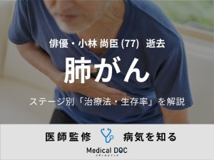 【訃報】俳優・小林尚臣さん 「肺がん」のステージ別の治療法・生存率を医師が解説