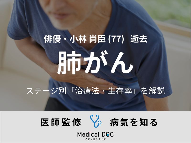 【訃報】俳優・小林尚臣さん 「肺がん」のステージ別の治療法・生存率を医師が解説