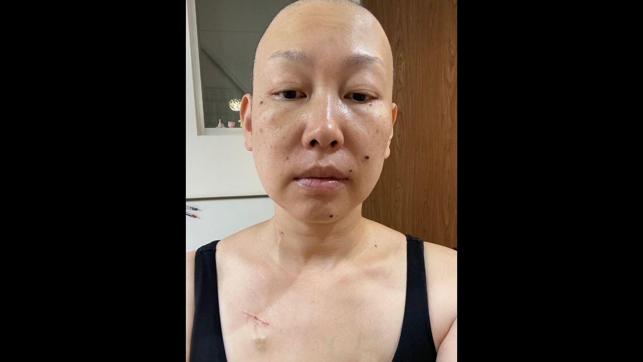 【闘病】『乳がん』宣告と終わらない治療の日々… 1児の母が痛感した健康と備えの後悔