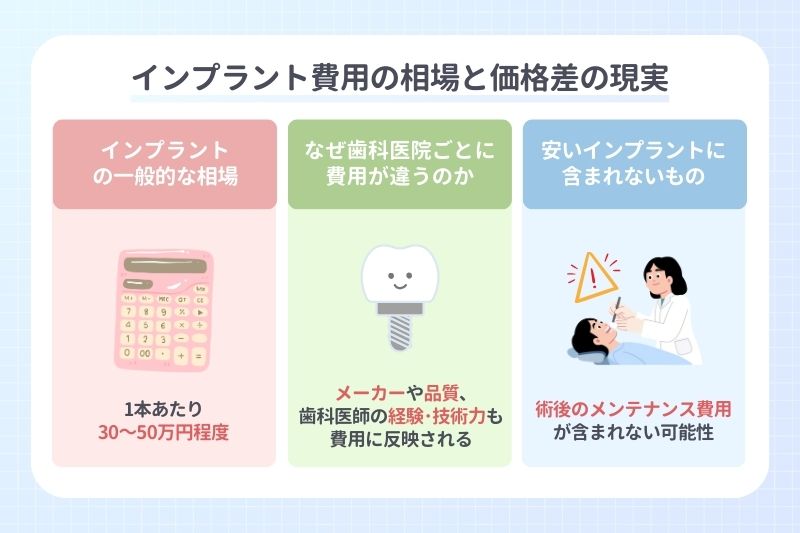 インプラント費用の相場と価格差の現実
