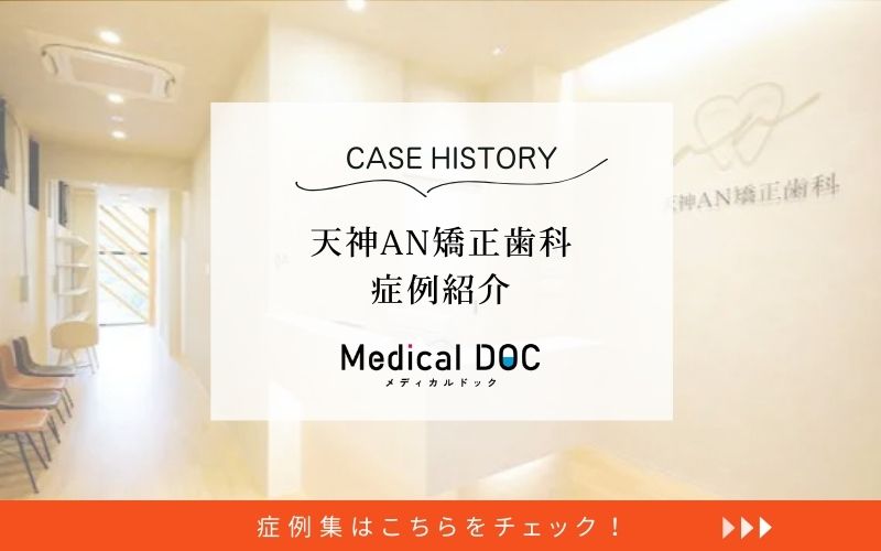 天神AN矯正歯科photo