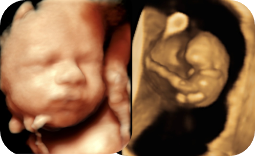 なぜ妊娠初期の受診が重要なのか