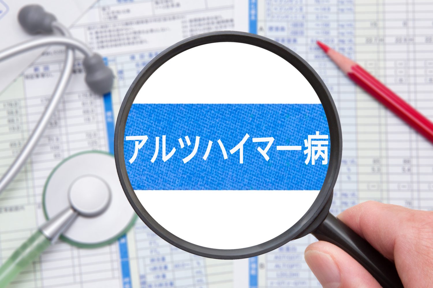 アルツハイマー病とはどのような病気？ 認知症との違いは？ 
