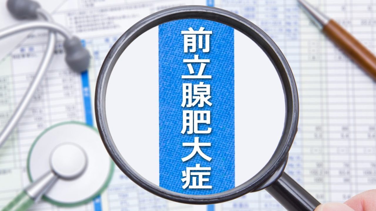 『前立腺肥大症』手術はどう選ぶ？ MISTやレーザーの違い【医師解説】