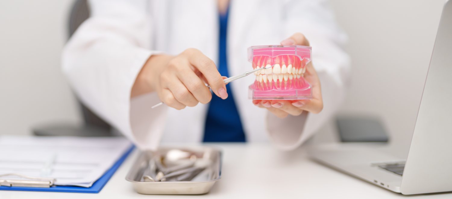 セットバックの主な種類