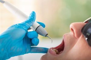 ブルーラジカルとは？効果・適応・注意点までわかりやすく解説