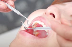 矯正治療で後悔しないために｜ワイヤー矯正とマウスピース型矯正のメリット・デメリット