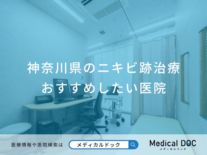 神奈川県のニキビ跡治療おすすめしたい医院