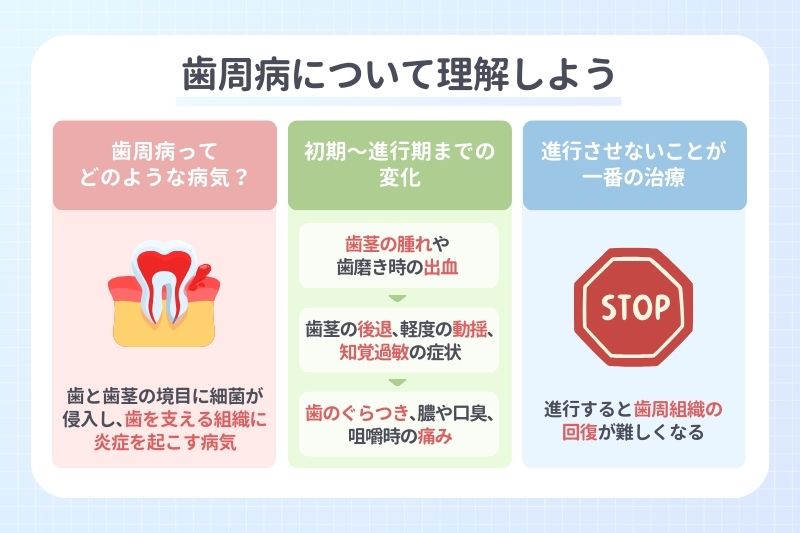 歯周病について理解しよう