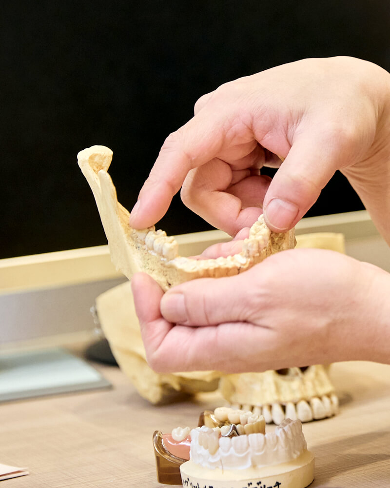 歯科医学的な観点で、欠損歯治療の治療に有効なインプラント