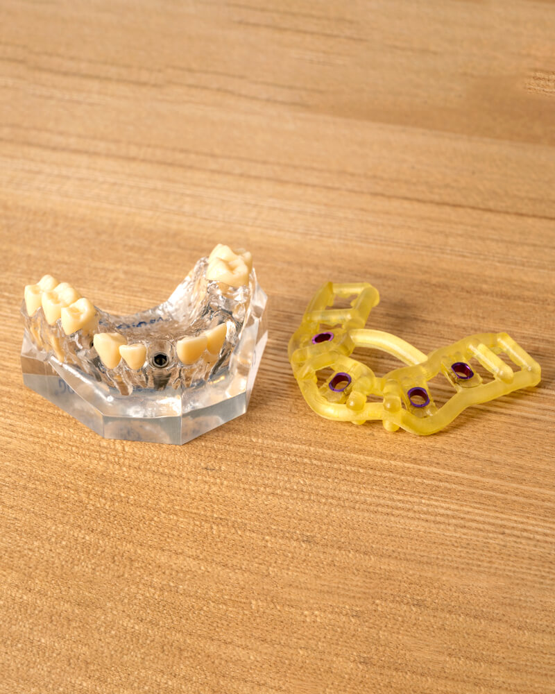 より安全で精密な治療を迅速に行えるようになってきた