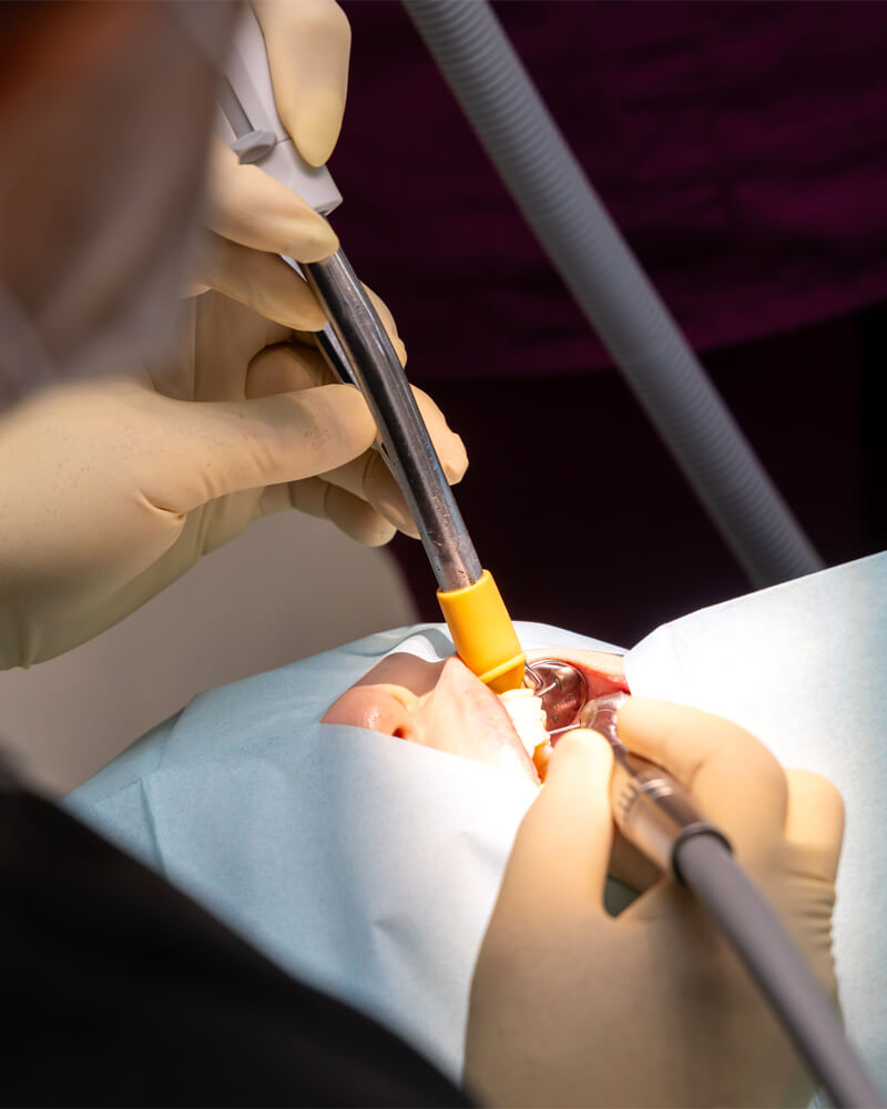  アンカースクリューとデジタル機器が広げる治療の選択肢