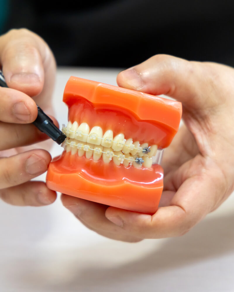 「予防」につながる矯正。小児矯正のタイミングとは