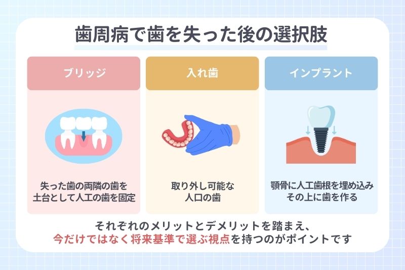 歯周病で歯を失った後の選択肢