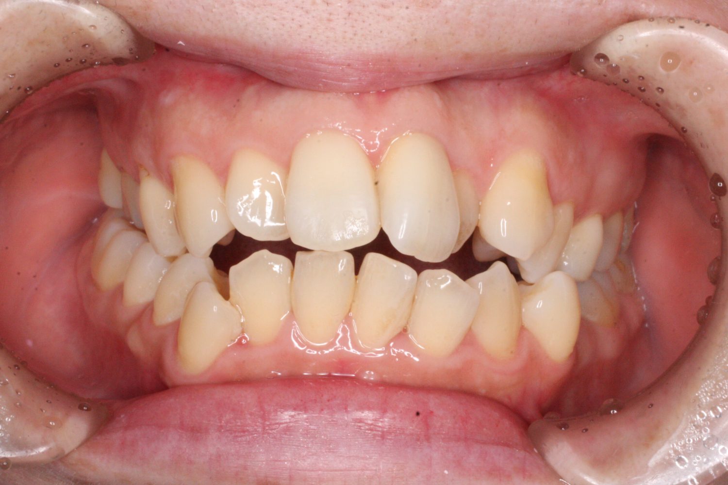 つちだ矯正歯科クリニック