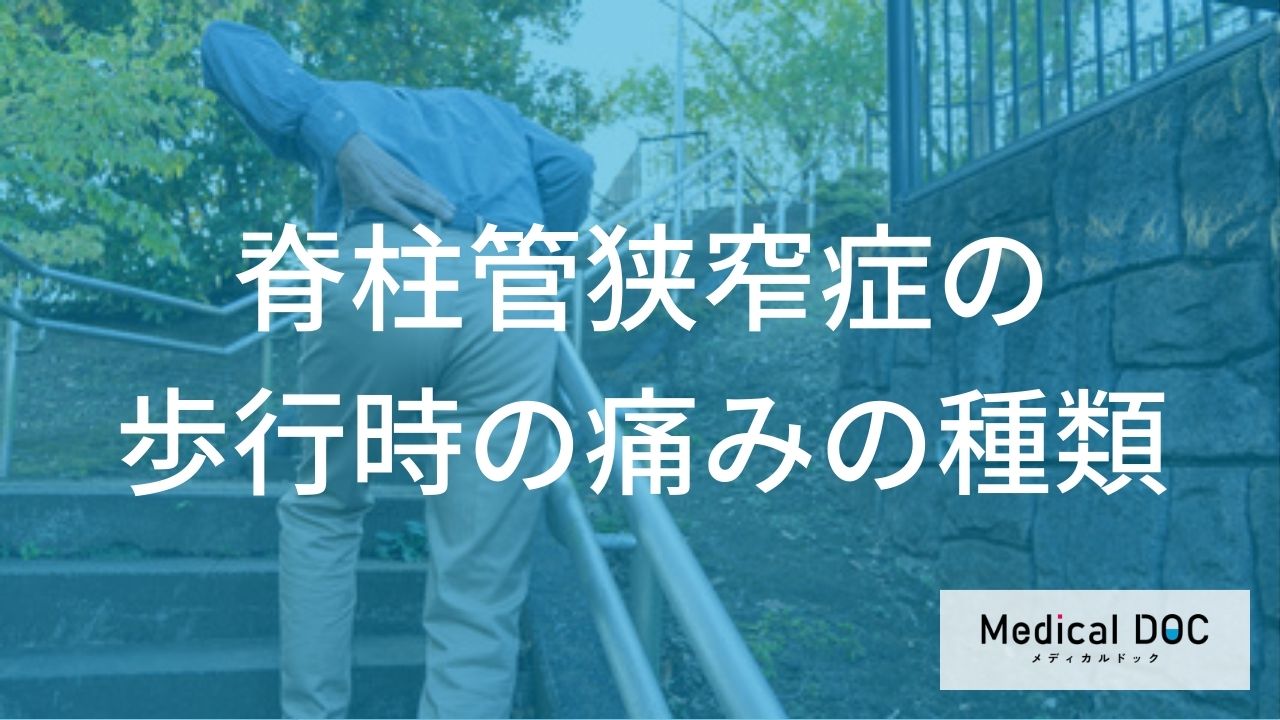 「脊柱管狭窄症」の痛みをご存知ですか? 多様な違和感の感じ方と初期症状