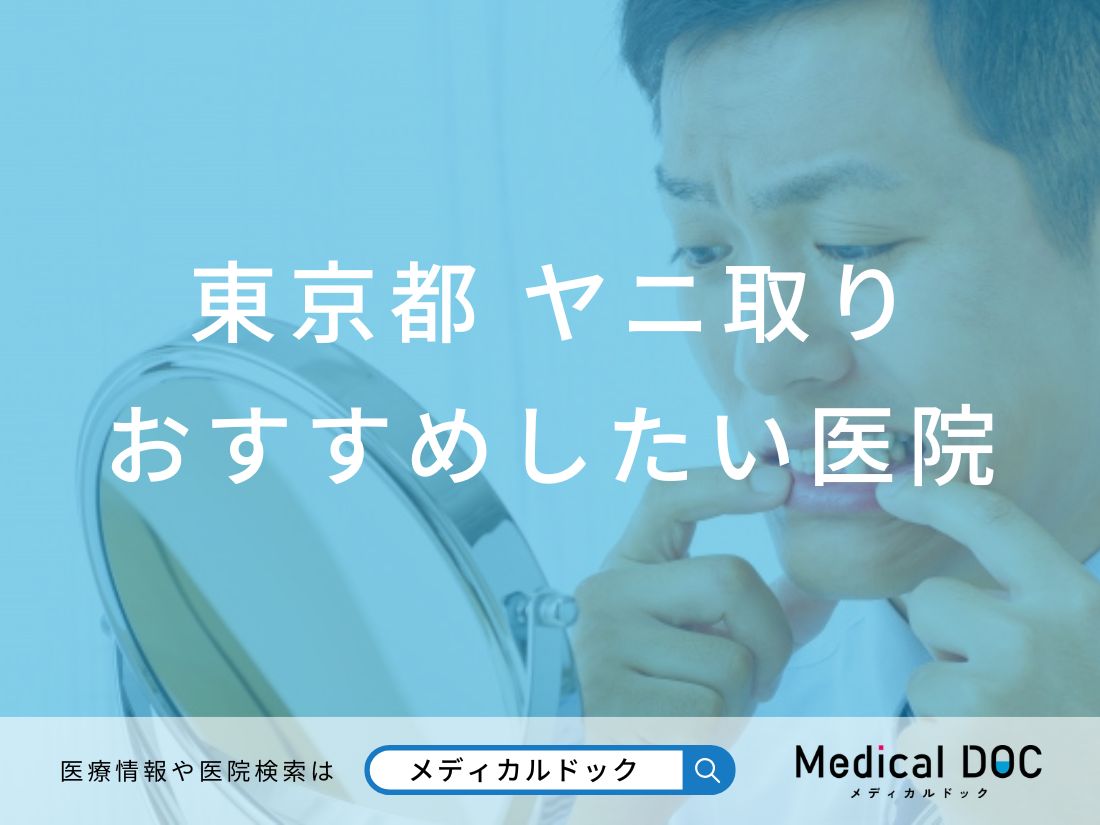 【2026年】東京都のヤニ取り おすすめしたい6医院