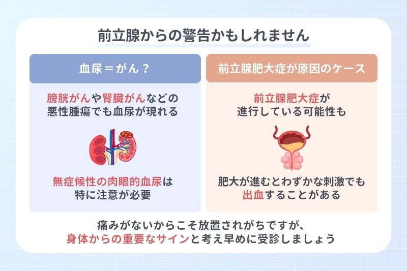 前立腺からの警告かもしれません