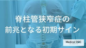 脊柱管狭窄症の前兆となる初期サイン