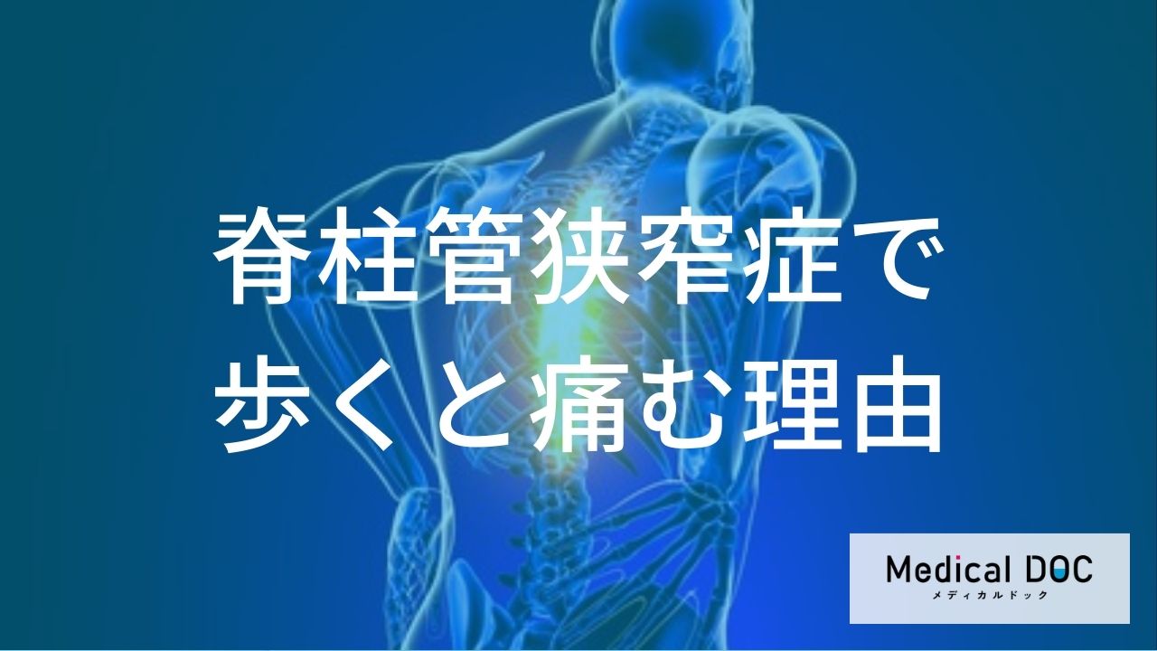「脊柱管狭窄症」少し休むとまた歩けるのはなぜ？ 不思議な症状の正体を専門家が解説