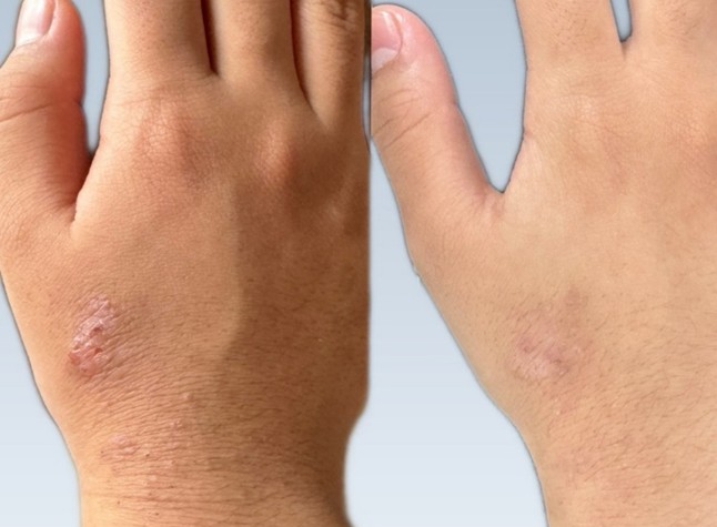 自分に合った治療法を見つけるためのポイント