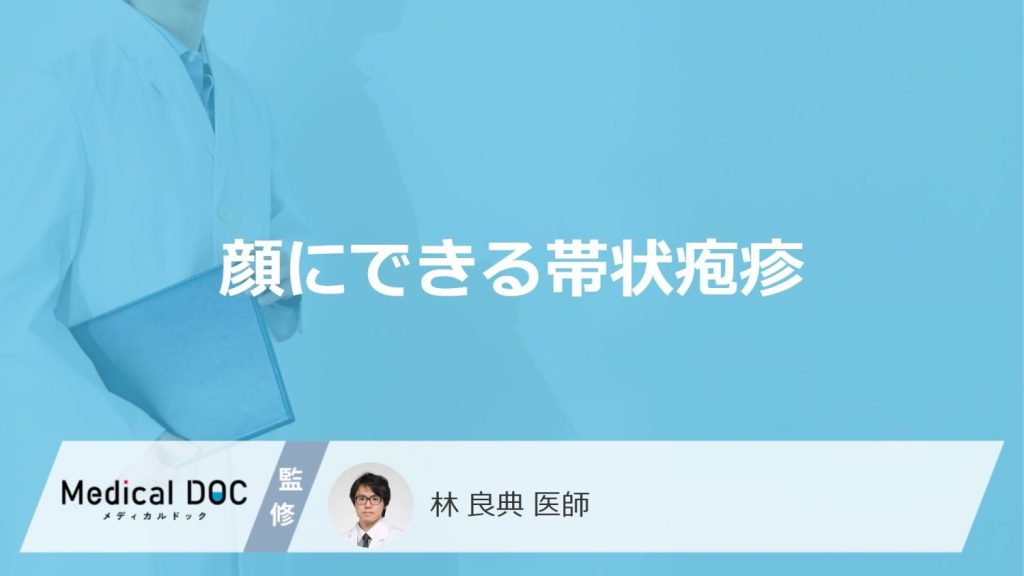 「顔にできる帯状疱疹」の特徴はご存知ですか？症状や跡が残る可能性も解説！