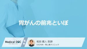 胃がんの前兆といぼ