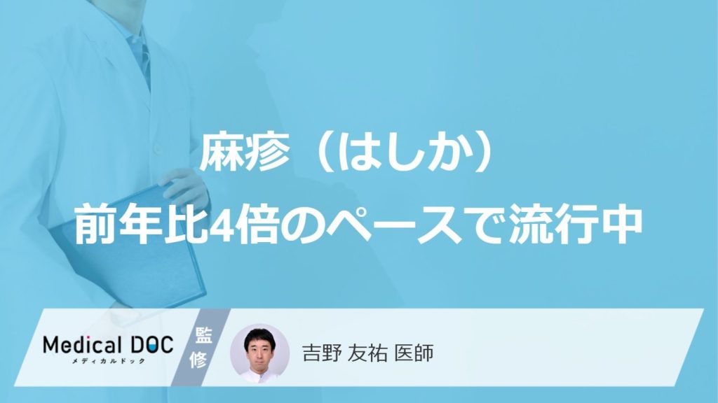 麻疹（はしか）前年比4倍のペースで流行中