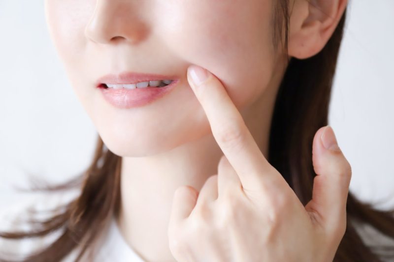 歯の形が尖っている原因は？放置するリスクや治療方法、犬歯と八重歯の違いを解説