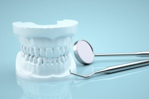 インプラント周囲炎の症状とは？歯周病との違いや段階別のサイン、セルフチェック方法も解説