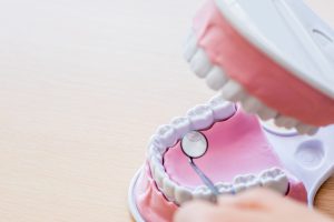 舌側矯正（裏側矯正）の種類と特徴は？治療法の選び方や後悔しないためのポイントを解説