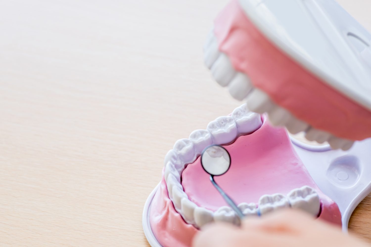 舌側矯正（裏側矯正）の種類と特徴は？治療法の選び方や後悔しないためのポイントを解説