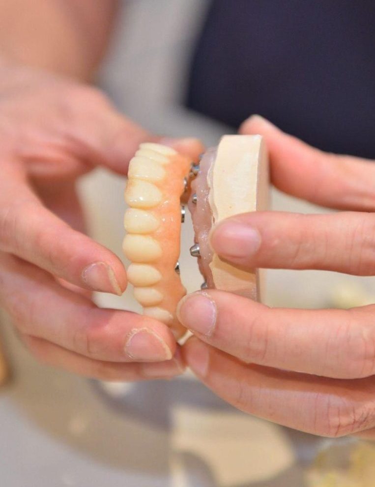 費用に加え、手術への漠然とした不安がインプラント治療を迷わせる